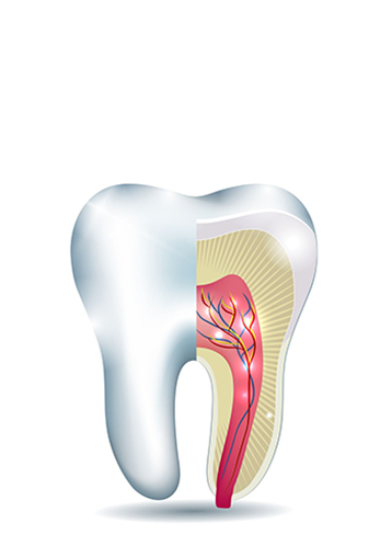 Root Canal Treatment - Treatment