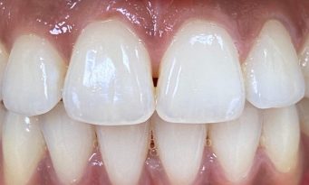 House of Dental - After